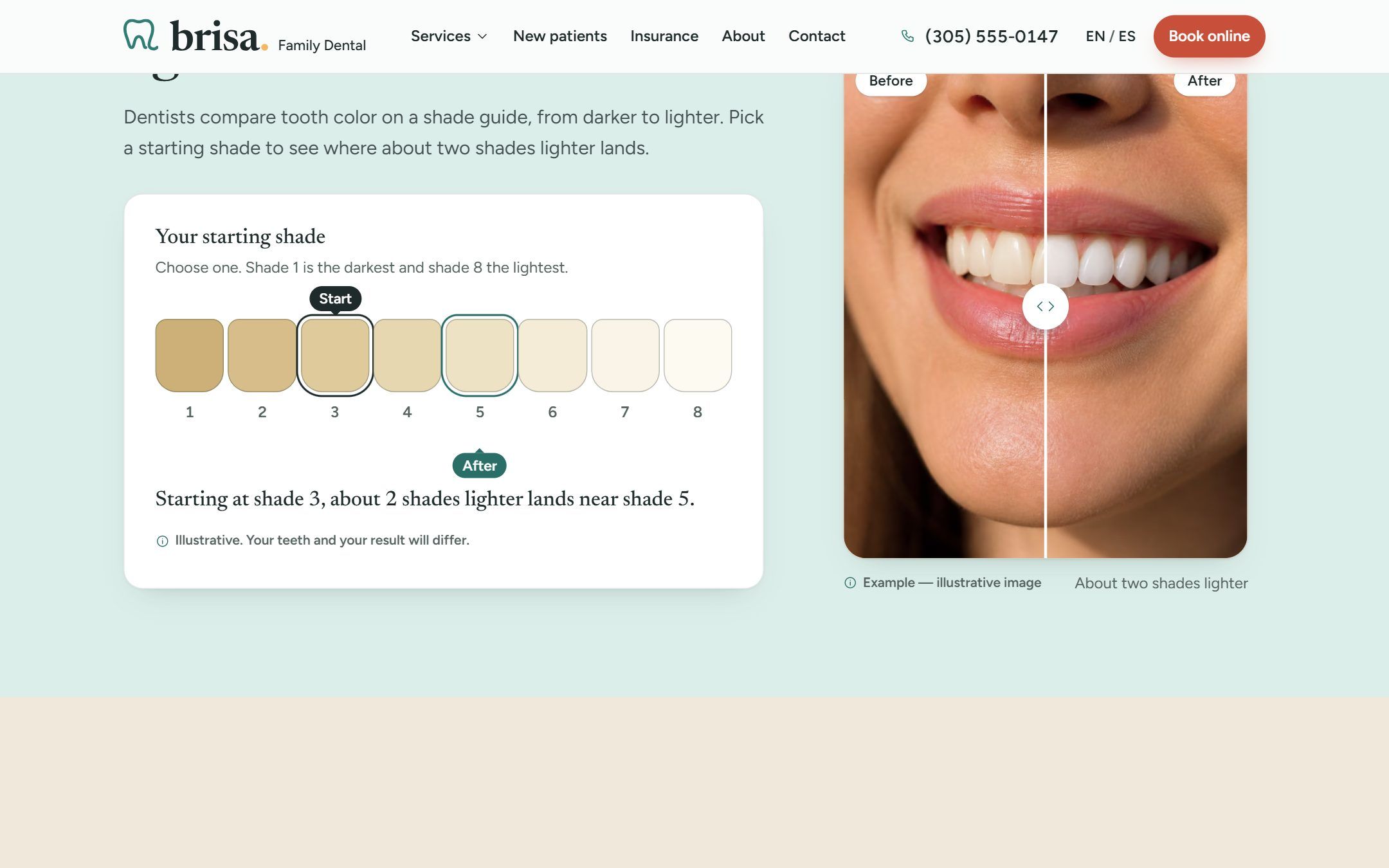 Teeth whitening page: a shade guide and a before and after slider of a smile, labelled 'Example, illustrative image'